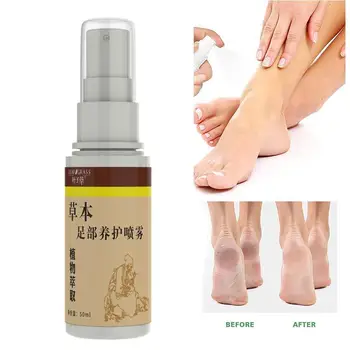 Protiplesňové Nohy Sprej Dezodorant Anti-Bakteriálne Prášok Proti Svrbeniu Potu Zápach Nôh Tekutých Rastlinných Športovec Starostlivosť O Nohy Sprej Na Starostlivosť O Nohy