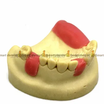 2018 vysokej kvality Zubný implantát školenia model Ústne implantát odbornej praxe model Čeľustného sinus lifting cvičenia