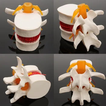 Ľudskej anatómie kostra Chrbtice, Bedrových herniácie Disku Výučby Model lebky, mozgu traumatické pištole školské potreby zdravotníckych instrume