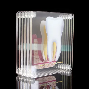 Sada 6 Zub Anatómia Zubov Model Akryl Tácky Zubné Tabuľka Tácky Pohár Mat Anatómie Lab Výučby Štúdium Výskum Nástroj