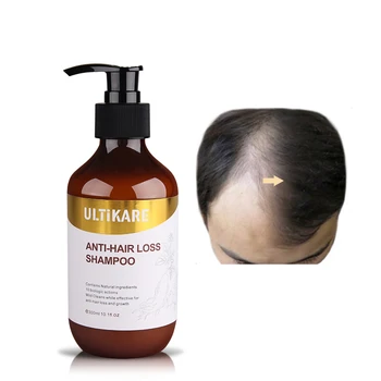 Anti-Hair Loss Nastaviť Opravy poškodených Vlasov Organické Zázvoru, 300 ml šampón+15ml Olej Rast Vlasov Produkt Prírodné Čínske Bylinné Vzorec