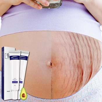 Hladký Krém Tuku vrásky Tehotenstva Odstránenie Materskej Kože Opravy telový Krém Soft Skin Stretch Označiť Jaziev Krémy