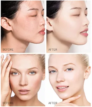 LAIKOU Sakura Nikotínamid Krém na Tvár Vyživujú Hydratujú Anti-Wrinkle Anti-Aging Zvýšiť Pružnosť Pokožky Bieliaci Krém na Tvár
