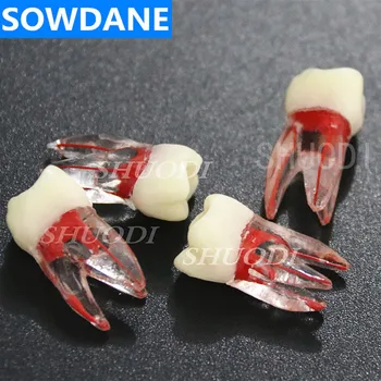 4 Ks 1:1 Živice Zubné Endodontic Študent Štúdium Praxi Prevádzky Model Farebné Koreňového Kanála a Celulózy Transparentné bez súbory