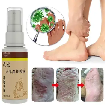 Protiplesňové Nohy Sprej Dezodorant Anti-Bakteriálne Prášok Proti Svrbeniu Potu Zápach Nôh Tekutých Rastlinných Športovec Starostlivosť O Nohy Sprej Na Starostlivosť O Nohy