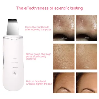 Ultrazvukové Kože Tváre Čistenie Sonic Pórov Cleaner Facial Cleanser Pokožky Práčky Blackhead Mieste Odstránenie Ultrazvukového Peelingu Stroj