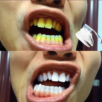 Bielenie zubov Prášok Rýchle Čistenie Škvŕn, Odstránenie stomatologickej Starostlivosti Fyzickej Whitener 50g zubná pasta Ústnej Hygieny Zlepšiť halitosis