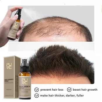 Vlasy Posilniť Šampón Bar & Anti Hair Loss Sprej Posilnenie Vlasovej Cibuľky Podporu Rastu Vlasov Sérum Thickener Husté Vlasy Starostlivosť